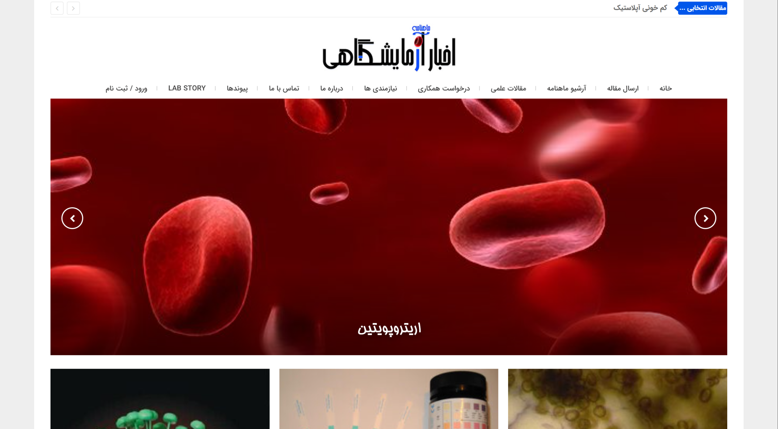 نمونه کار رادین وب: medlabnews.ir - رسانه و اخبار پزشکی